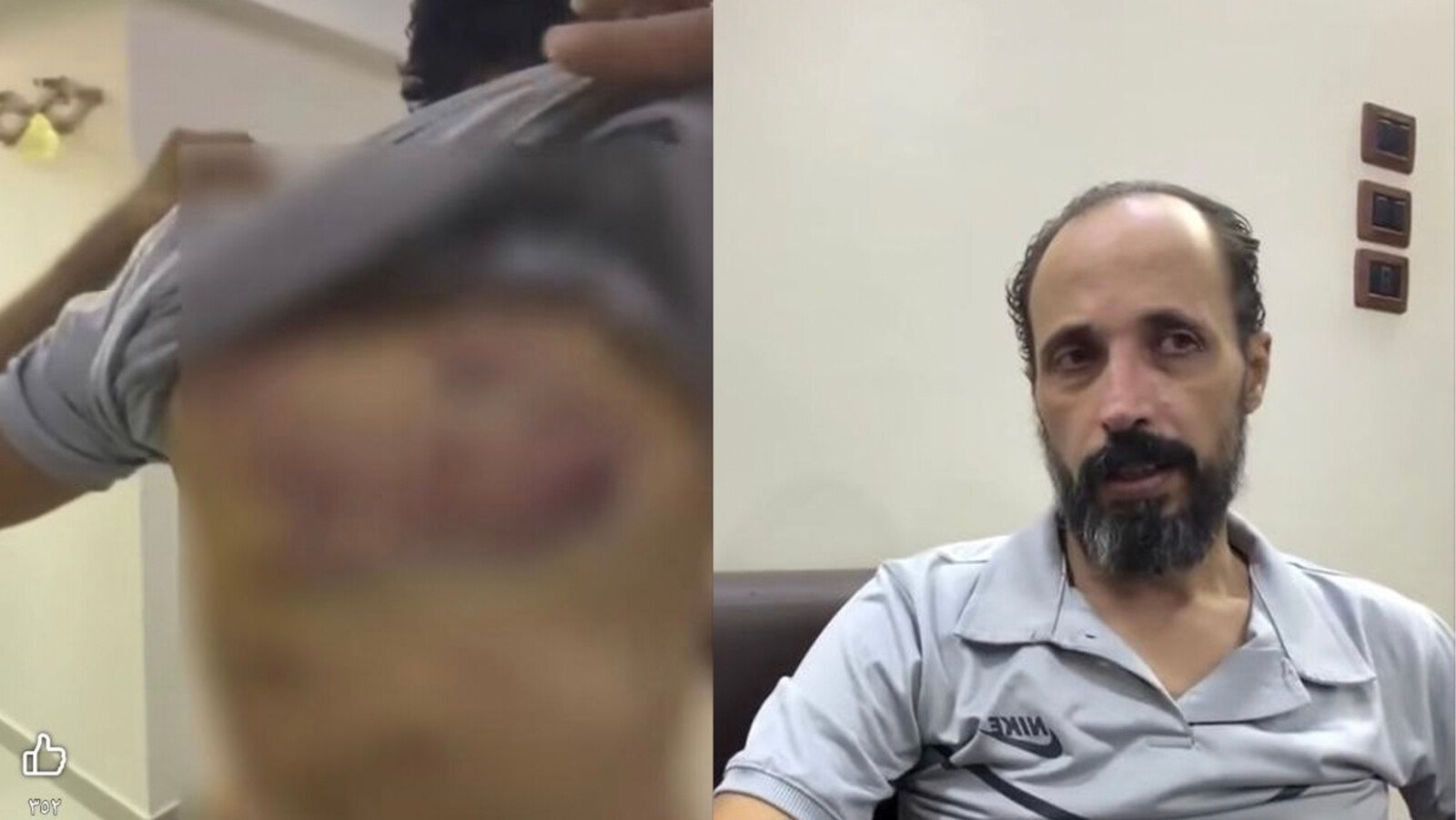 مهند أبو نصار يعود إلى أهله بعد اختطافه في السويداء .. فدية بـ200 ألف دولار وآثار تعذيب على جسده
